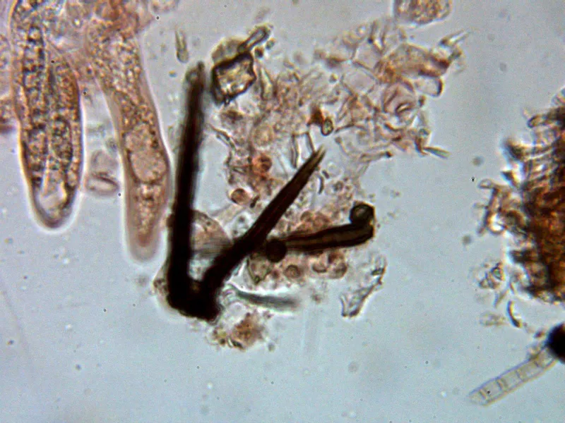 Capronia fusispora 10 - Pelos marginales